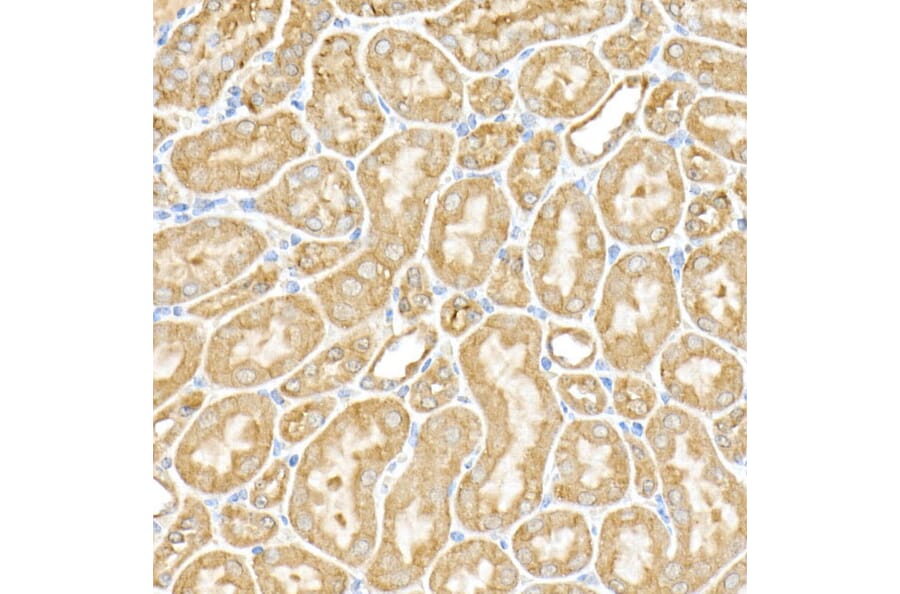 Immunohistochemistry - Anti-RPGR Antibody (A13696) - Antibodies.com
