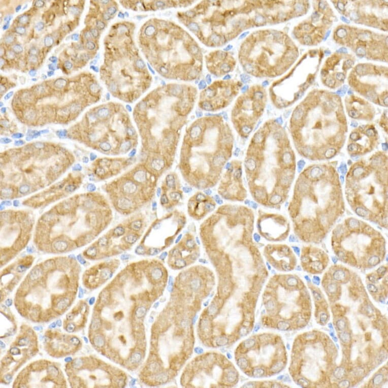 Immunohistochemistry - Anti-RPGR Antibody (A13696) - Antibodies.com