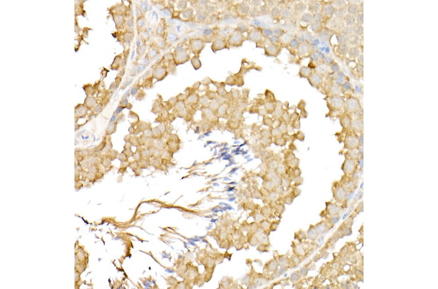 Immunohistochemistry - Anti-RPGR Antibody (A13696) - Antibodies.com