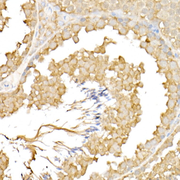 Immunohistochemistry - Anti-RPGR Antibody (A13696) - Antibodies.com