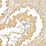 Immunohistochemistry - Anti-RPGR Antibody (A13696) - Antibodies.com