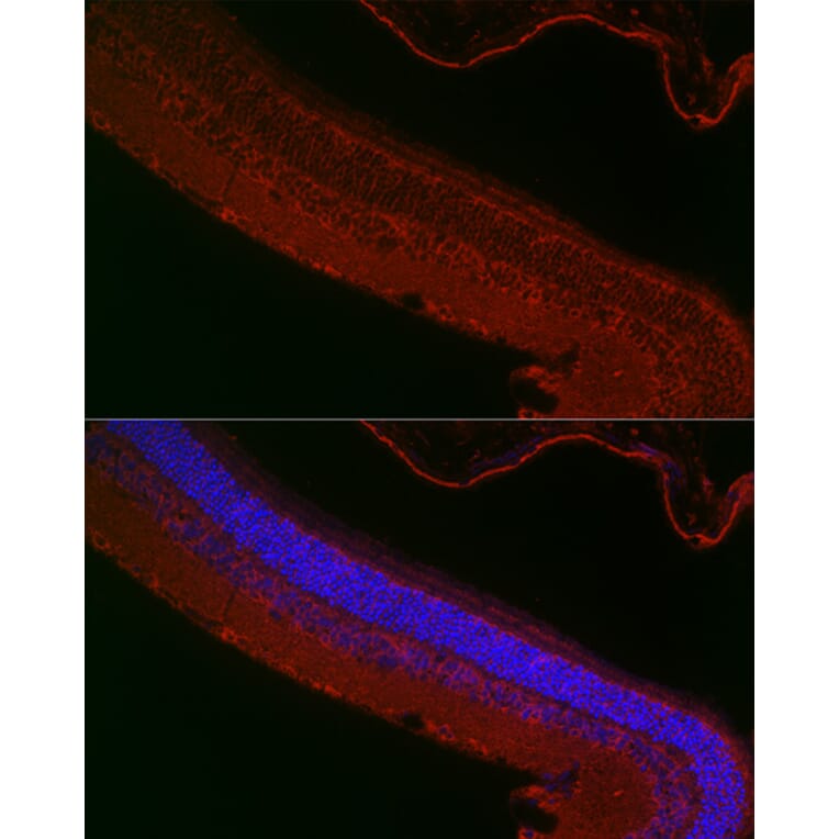 Immunofluorescence - Anti-RPGR Antibody (A13696) - Antibodies.com