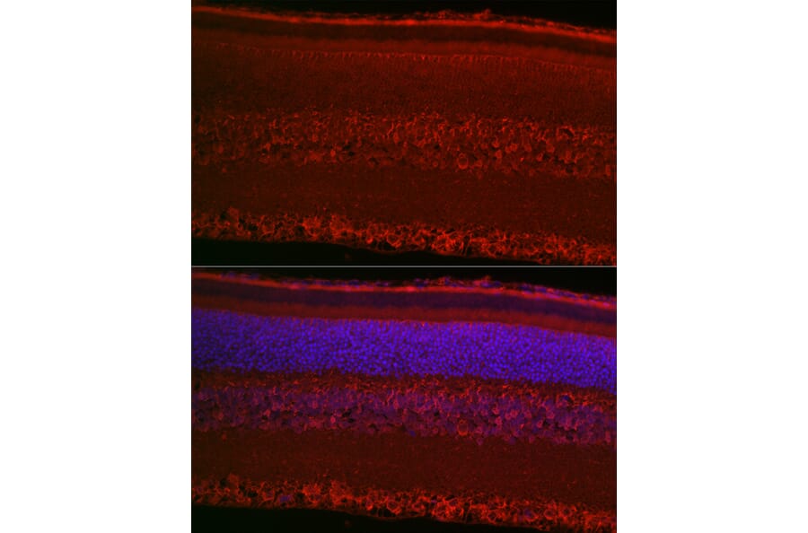 Immunofluorescence - Anti-RPGR Antibody (A13696) - Antibodies.com
