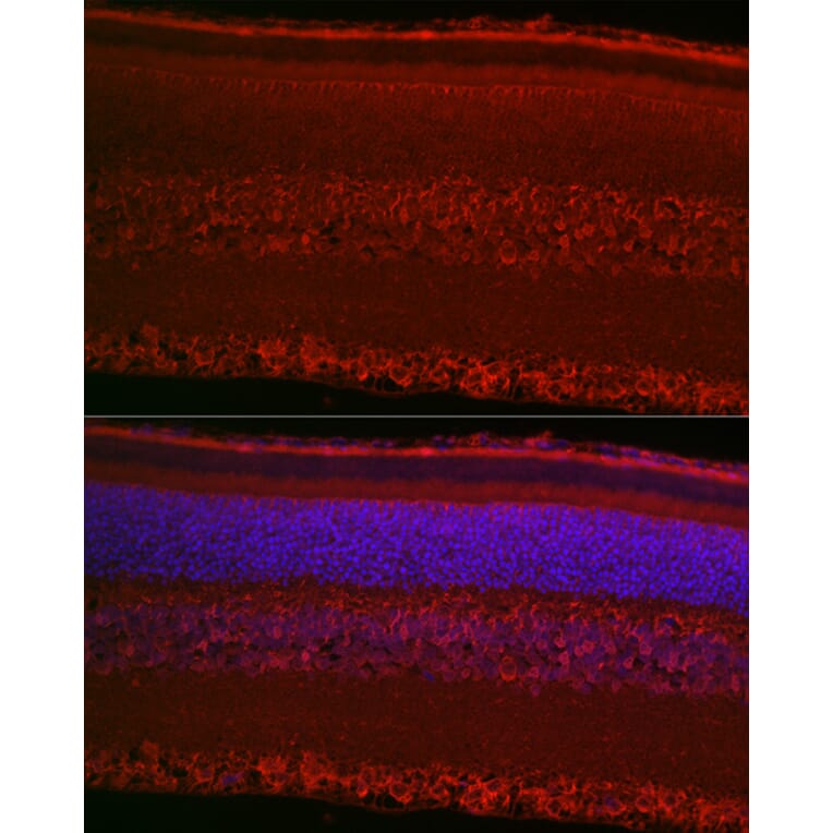 Immunofluorescence - Anti-RPGR Antibody (A13696) - Antibodies.com