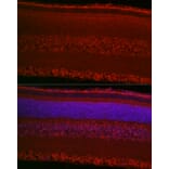 Immunofluorescence - Anti-RPGR Antibody (A13696) - Antibodies.com