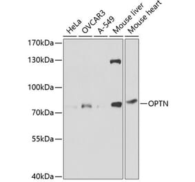 Western Blot - Anti-Optineurin Antibody (A13697) - Antibodies.com