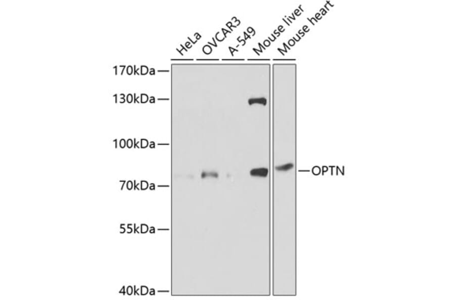 Western Blot - Anti-Optineurin Antibody (A13697) - Antibodies.com
