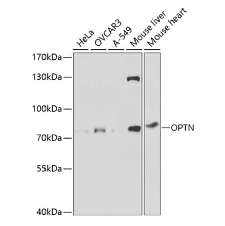 Western Blot - Anti-Optineurin Antibody (A13697) - Antibodies.com