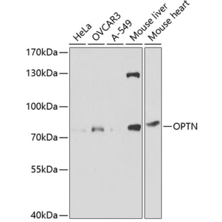 Western Blot - Anti-Optineurin Antibody (A13697) - Antibodies.com