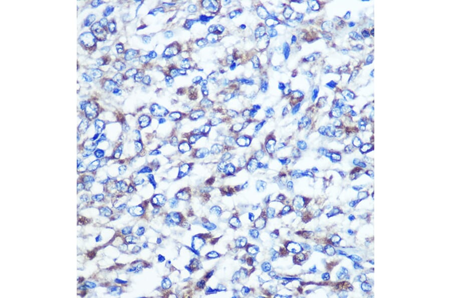 Immunohistochemistry - Anti-Optineurin Antibody (A13697) - Antibodies.com