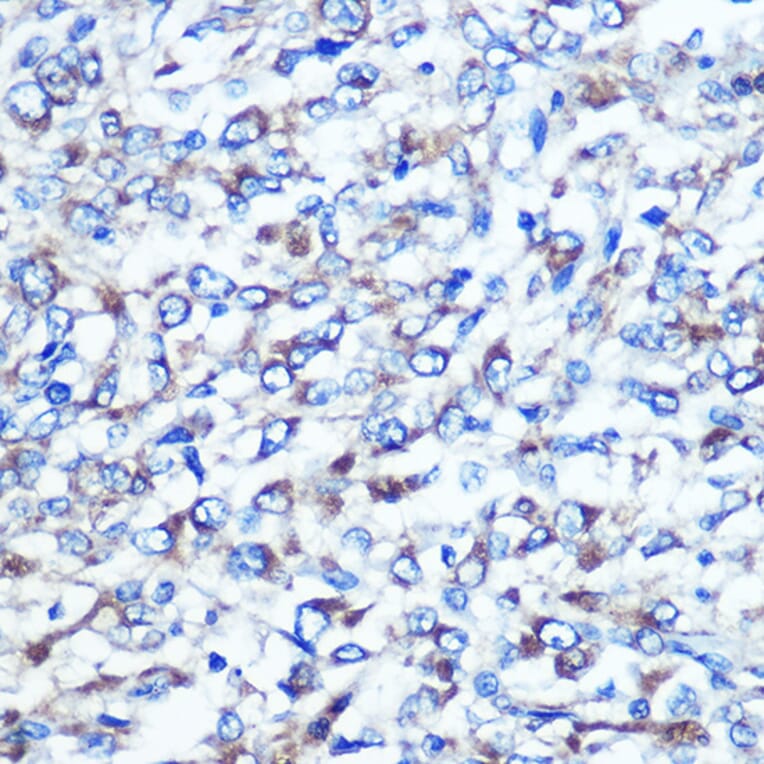 Immunohistochemistry - Anti-Optineurin Antibody (A13697) - Antibodies.com