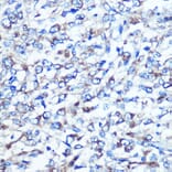 Immunohistochemistry - Anti-Optineurin Antibody (A13697) - Antibodies.com