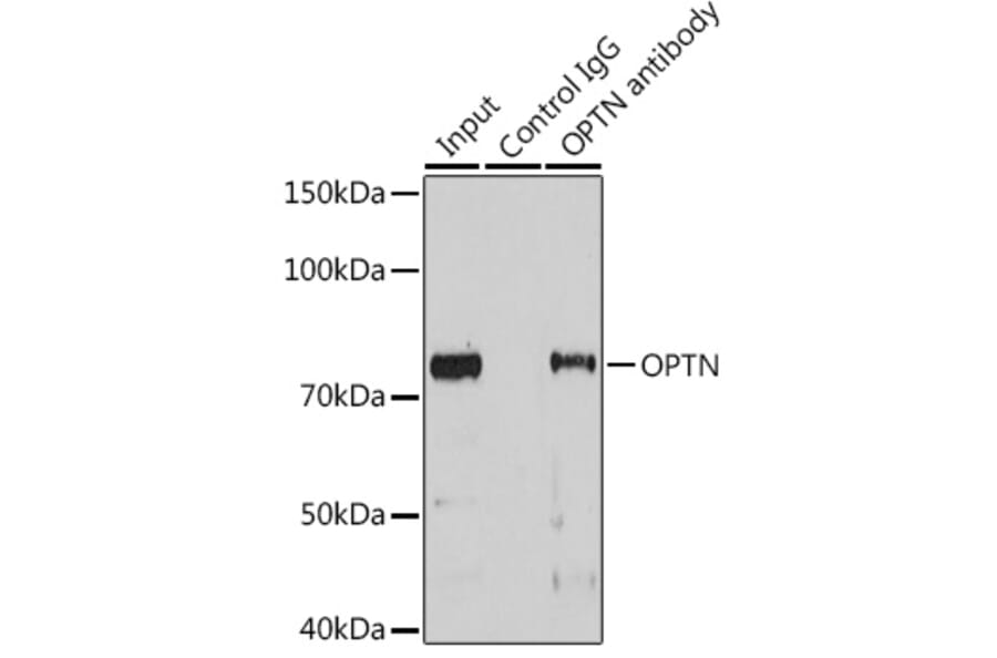 Western Blot - Anti-Optineurin Antibody (A13697) - Antibodies.com