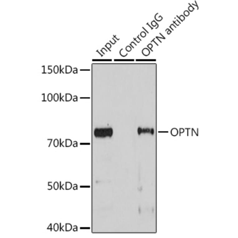 Western Blot - Anti-Optineurin Antibody (A13697) - Antibodies.com