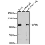 Western Blot - Anti-Optineurin Antibody (A13697) - Antibodies.com