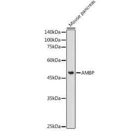 Western Blot - Anti-Alpha 1 microglobulin Antibody (A13698) - Antibodies.com