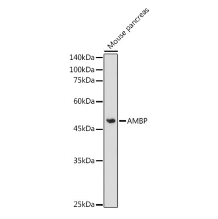 Western Blot - Anti-Alpha 1 microglobulin Antibody (A13698) - Antibodies.com