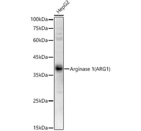 Western Blot - Anti-Liver Arginase Antibody (A13699) - Antibodies.com