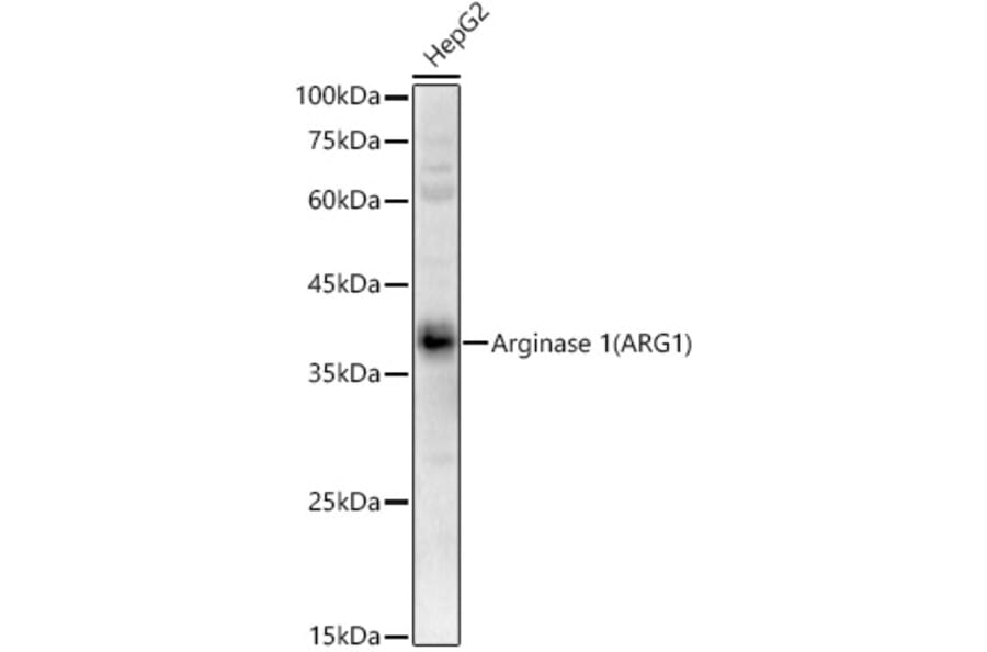 Western Blot - Anti-Liver Arginase Antibody (A13699) - Antibodies.com