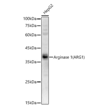 Western Blot - Anti-Liver Arginase Antibody (A13699) - Antibodies.com