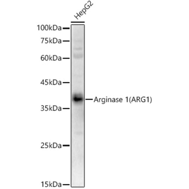 Western Blot - Anti-Liver Arginase Antibody (A13699) - Antibodies.com