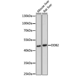 Western Blot - Anti-DDB2 Antibody (A13700) - Antibodies.com