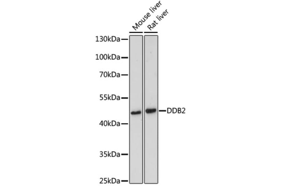 Western Blot - Anti-DDB2 Antibody (A13700) - Antibodies.com