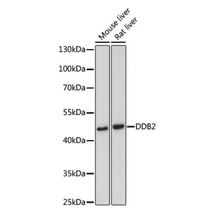 Western Blot - Anti-DDB2 Antibody (A13700) - Antibodies.com