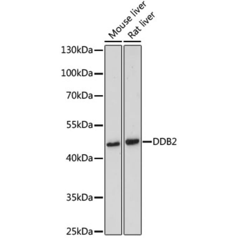 Western Blot - Anti-DDB2 Antibody (A13700) - Antibodies.com