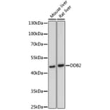 Western Blot - Anti-DDB2 Antibody (A13700) - Antibodies.com