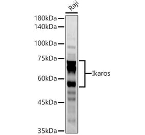 Western Blot - Anti-Ikaros Antibody (A13701) - Antibodies.com