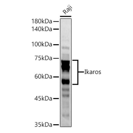 Western Blot - Anti-Ikaros Antibody (A13701) - Antibodies.com