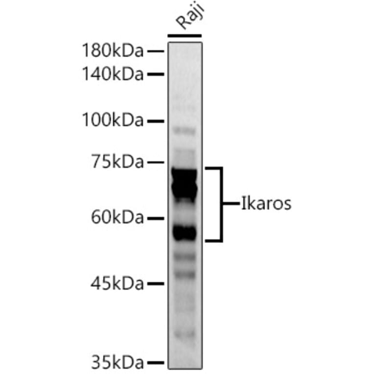 Western Blot - Anti-Ikaros Antibody (A13701) - Antibodies.com