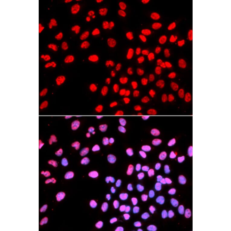 Chromatin Immunoprecipitation - Anti-Ikaros Antibody (A13701) - Antibodies.com