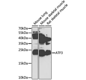 Western Blot - Anti-ATF3 Antibody (A13702) - Antibodies.com