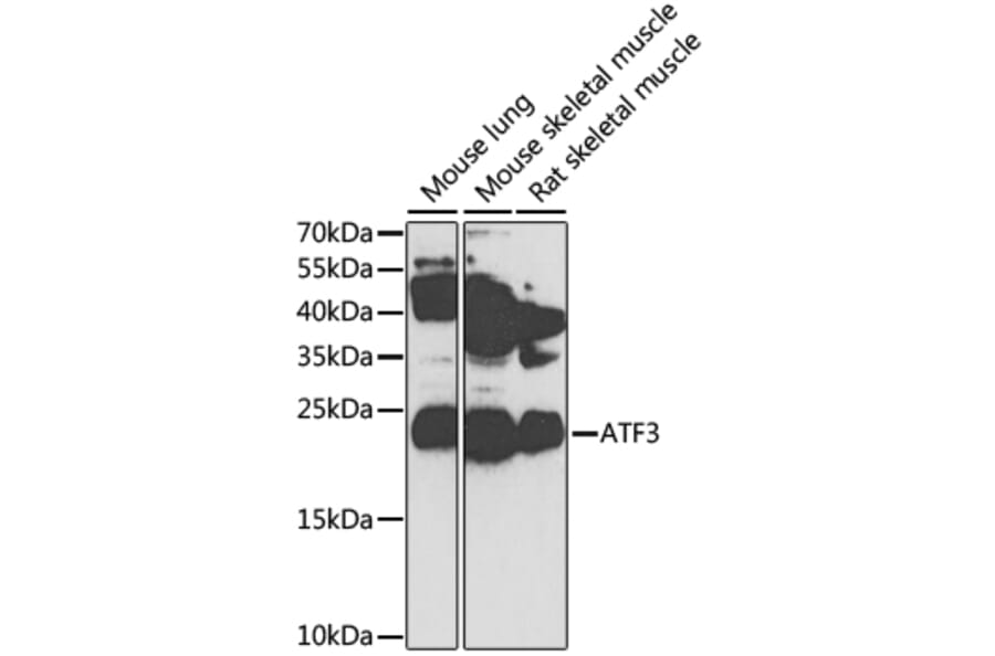 Western Blot - Anti-ATF3 Antibody (A13702) - Antibodies.com