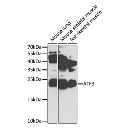 Western Blot - Anti-ATF3 Antibody (A13702) - Antibodies.com