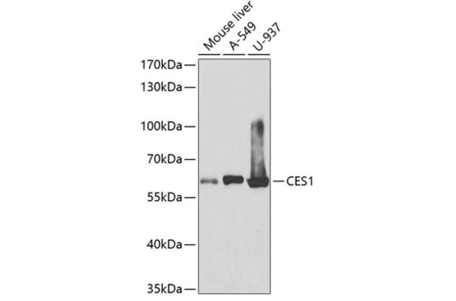 Western Blot - Anti-Liver Carboxylesterase 1/CES1 Antibody (A13703) - Antibodies.com