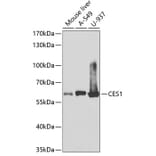 Western Blot - Anti-Liver Carboxylesterase 1/CES1 Antibody (A13703) - Antibodies.com