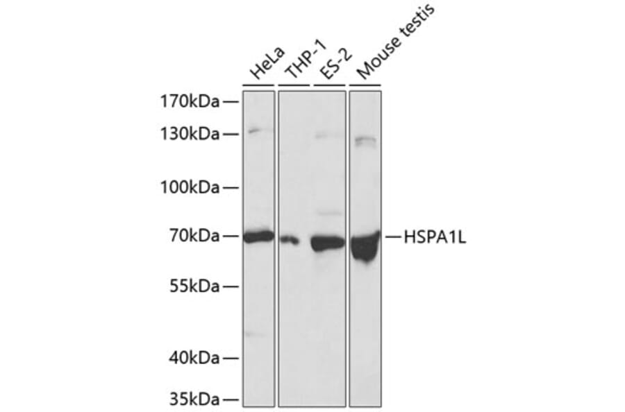 Western Blot - Anti-HSPA1L Antibody (A13704) - Antibodies.com