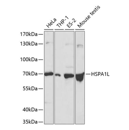 Western Blot - Anti-HSPA1L Antibody (A13704) - Antibodies.com