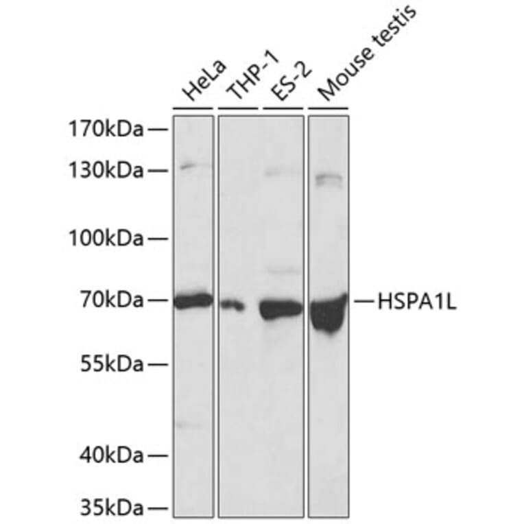 Western Blot - Anti-HSPA1L Antibody (A13704) - Antibodies.com