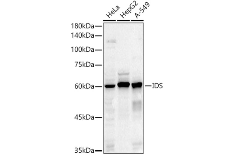 Western Blot - Anti-Iduronate 2 sulfatase/SIDS Antibody (A13705) - Antibodies.com