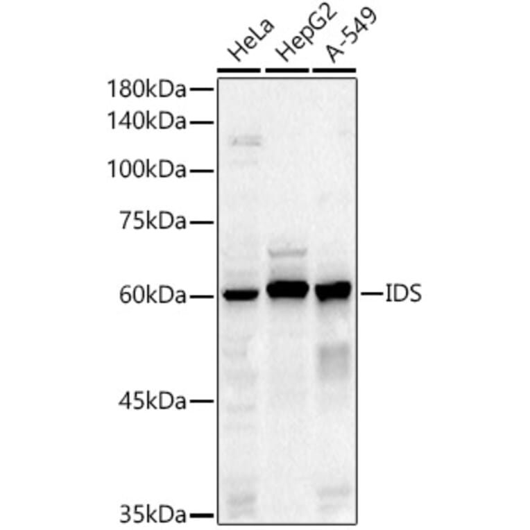Western Blot - Anti-Iduronate 2 sulfatase/SIDS Antibody (A13705) - Antibodies.com