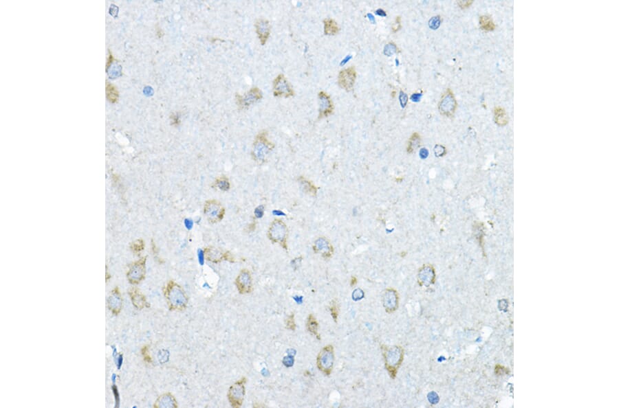 Immunohistochemistry - Anti-Iduronate 2 sulfatase/SIDS Antibody (A13705) - Antibodies.com