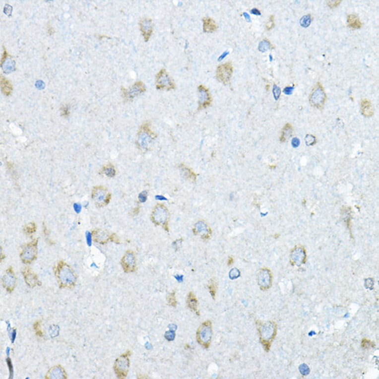 Immunohistochemistry - Anti-Iduronate 2 sulfatase/SIDS Antibody (A13705) - Antibodies.com