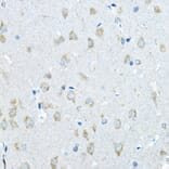 Immunohistochemistry - Anti-Iduronate 2 sulfatase/SIDS Antibody (A13705) - Antibodies.com