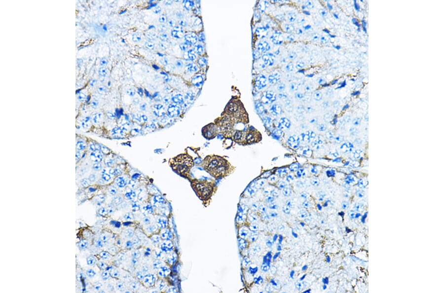 Immunohistochemistry - Anti-Iduronate 2 sulfatase/SIDS Antibody (A13705) - Antibodies.com