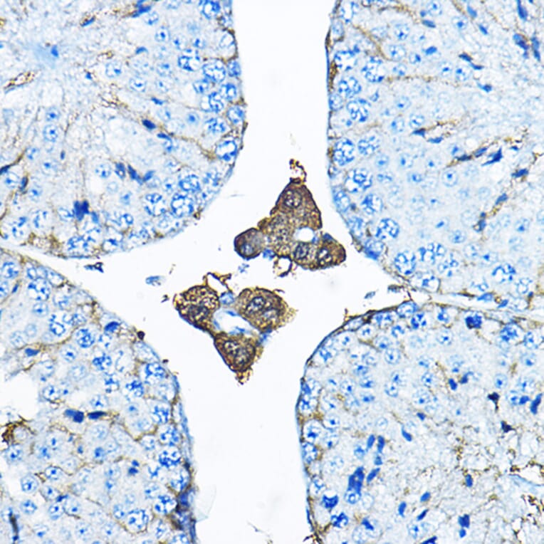 Immunohistochemistry - Anti-Iduronate 2 sulfatase/SIDS Antibody (A13705) - Antibodies.com