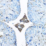 Immunohistochemistry - Anti-Iduronate 2 sulfatase/SIDS Antibody (A13705) - Antibodies.com